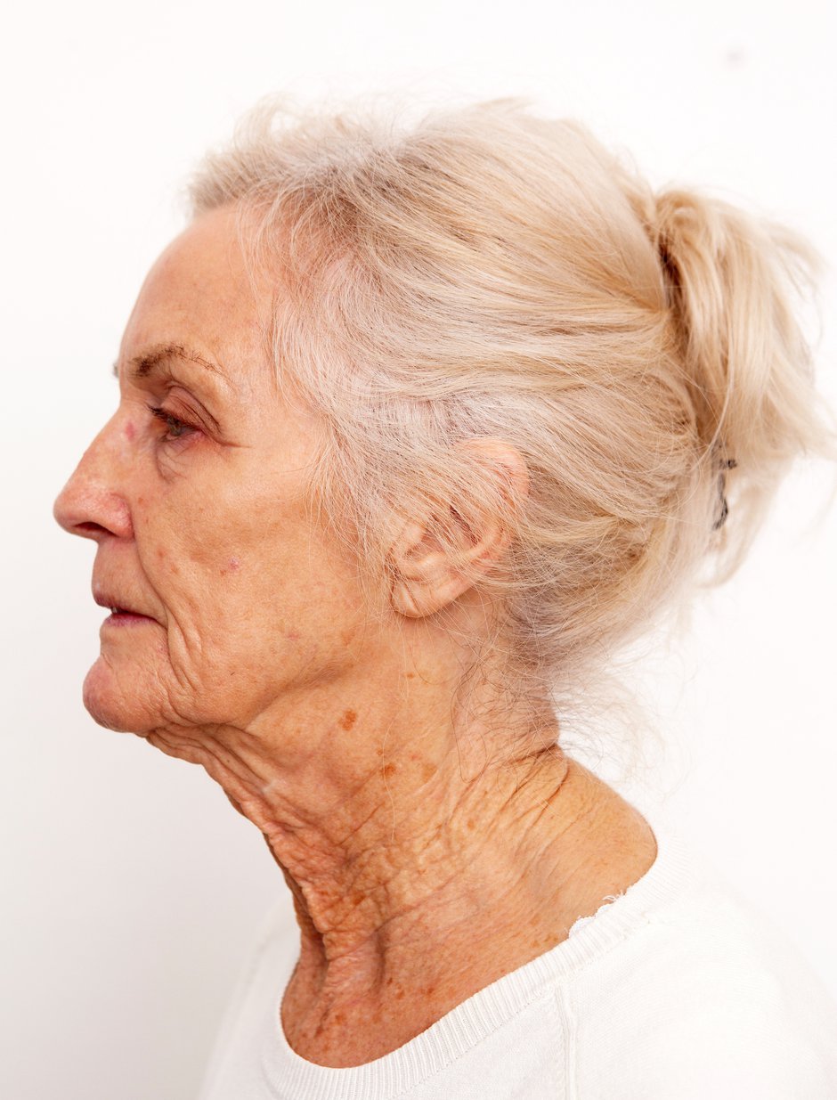 SWNS_FACELIFT_GRAN_15.jpg