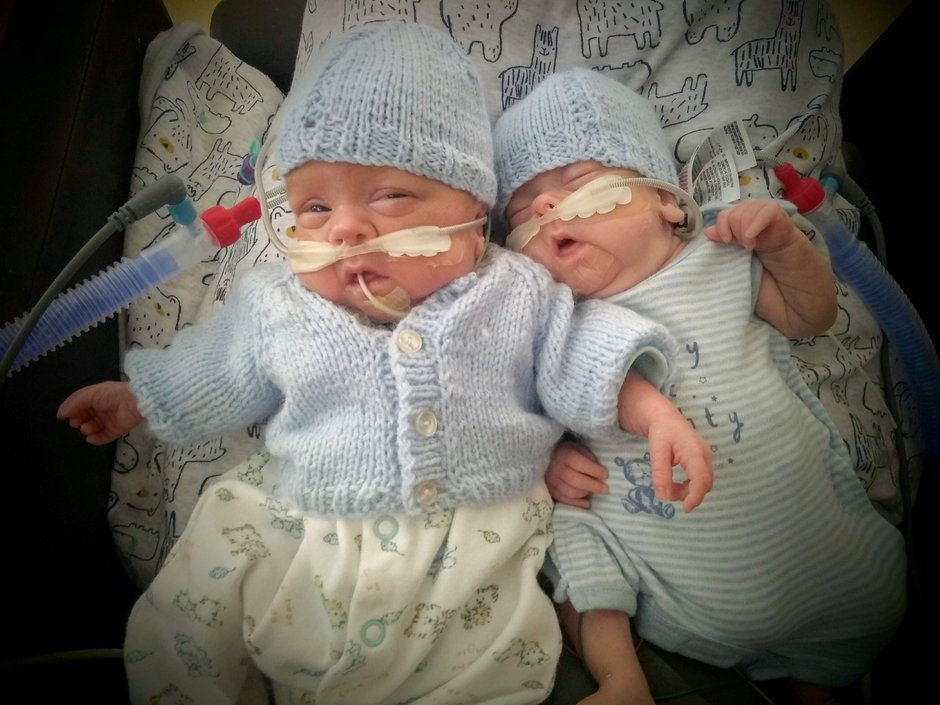 SWNS_KEATES_TWINS_013.jpg